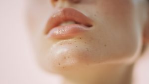 Чёрные точки: почему появляются и как их убрать?