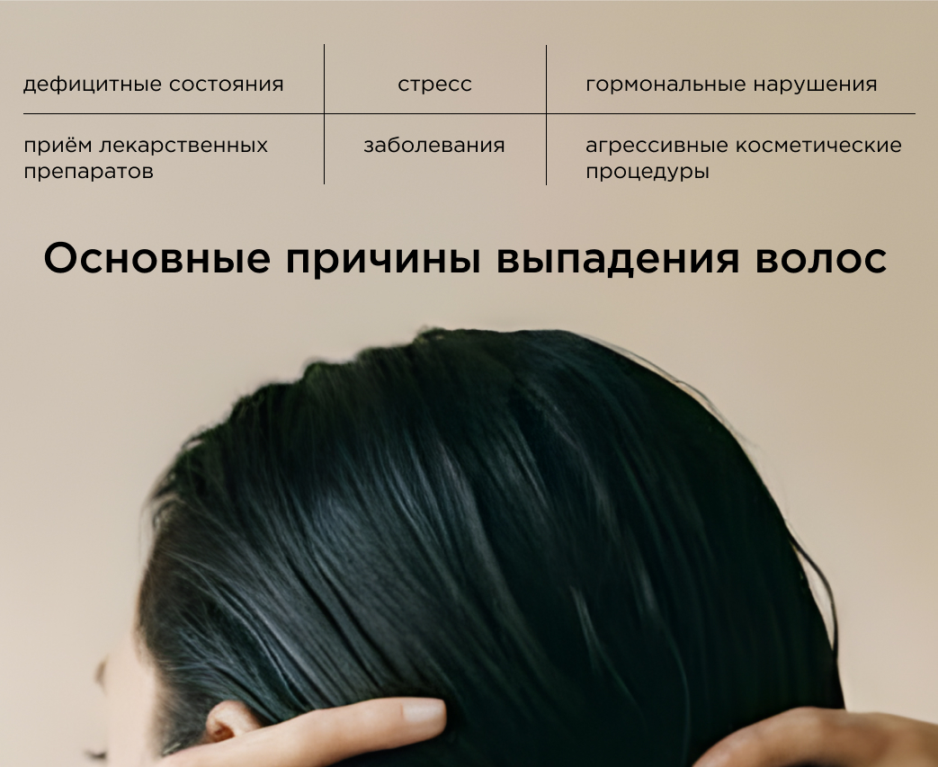 причины выпадения волос, инфографика