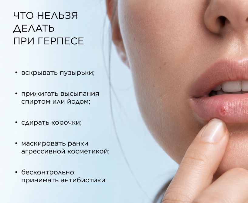 Что нельзя делать при герпесе