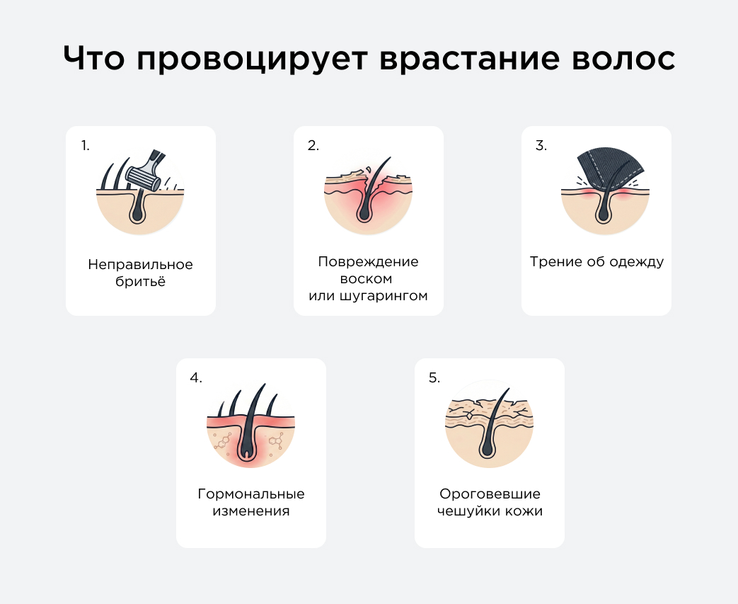 Что провоцирует врастание волос
