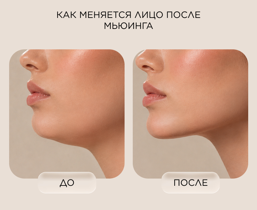Как меняется лицо после мьюинга