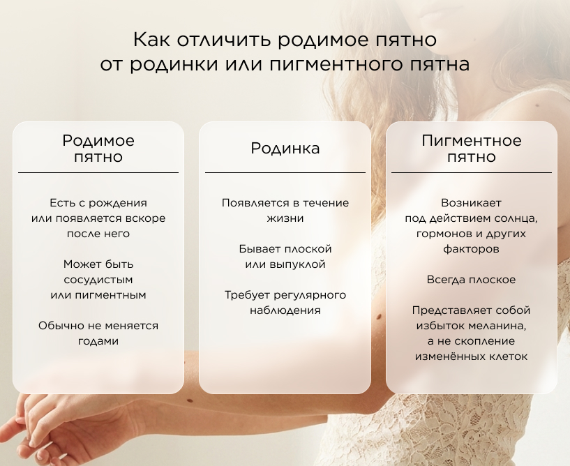 Как отличить родимое пятно от родинки или пигментного пятна