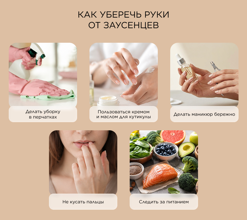 Как уберечь руки от заусенцев
