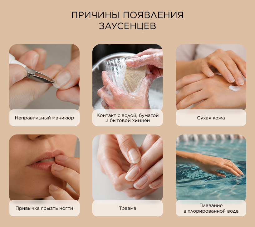 Причины появления заусенцев
