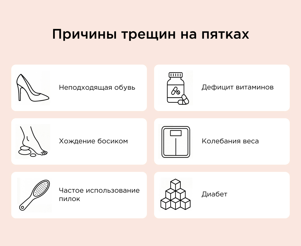 Причины трещин на пятках

