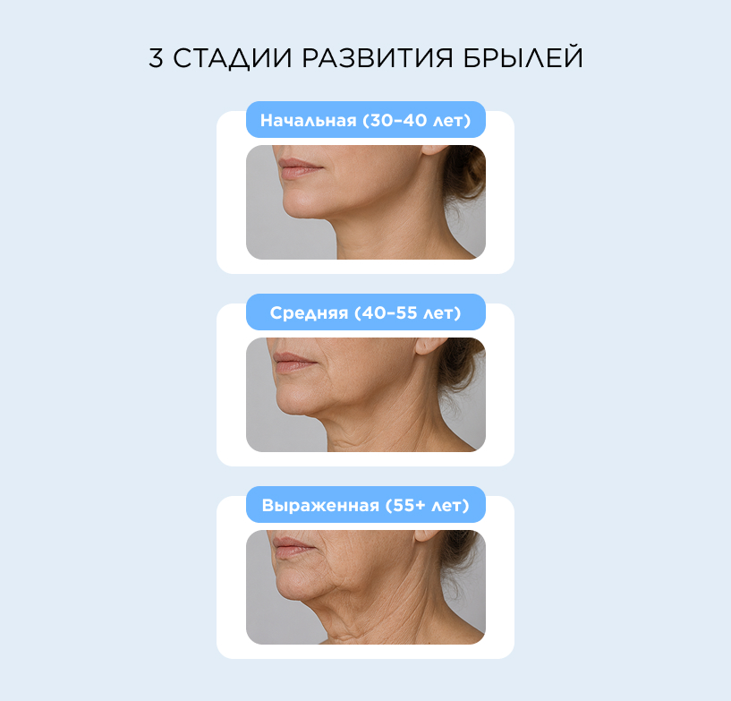 3 стадии развития брылей
