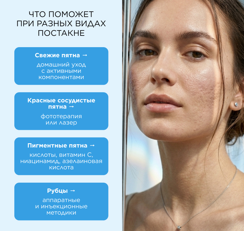 Что поможет при разных видах постакн