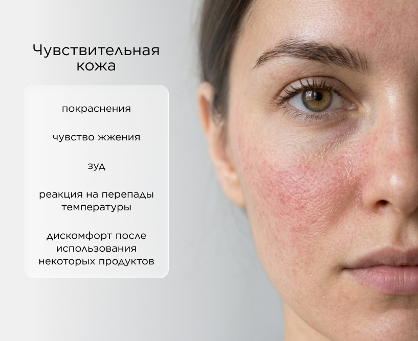 Чувствительная кожа