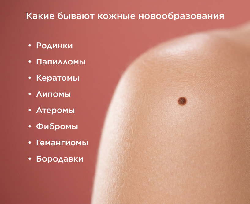 Какие бывают кожные новообразования