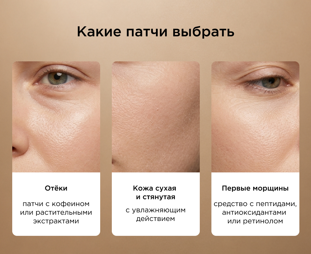 какие патчи выбрать