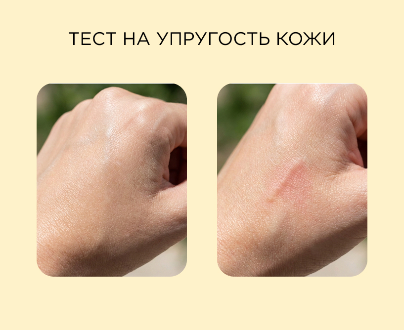 Тест на упругость кожи