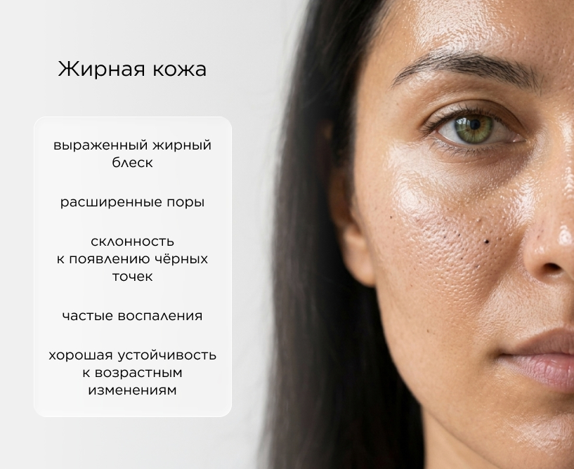 Жирная кожа