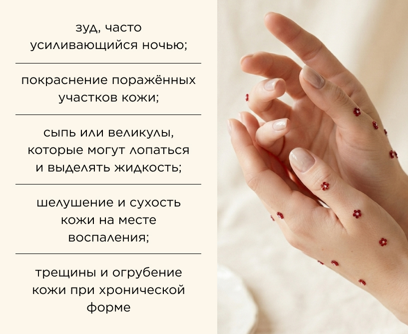 Симптомы экземы