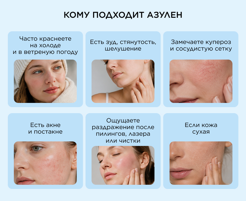 Кому подходит азулен