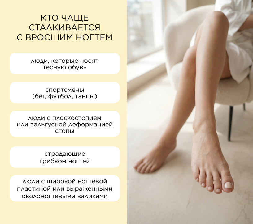 Кто чаще сталкивается с вросшим ногтем