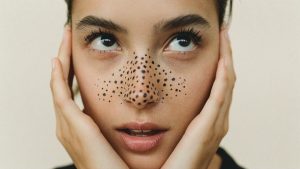 Что такое чёрные точки? Можно ли удалить их с помощью чистки лица
