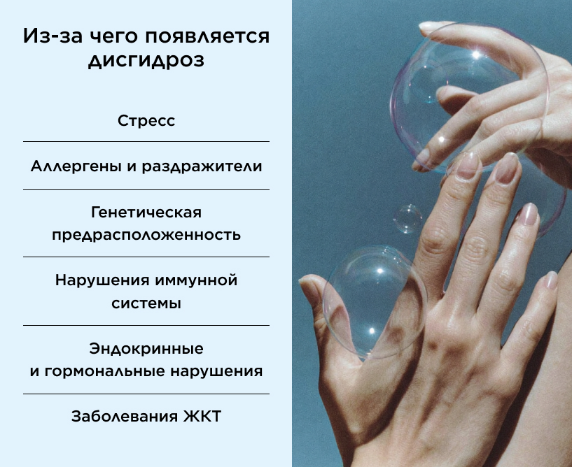 Причины дисгидроза