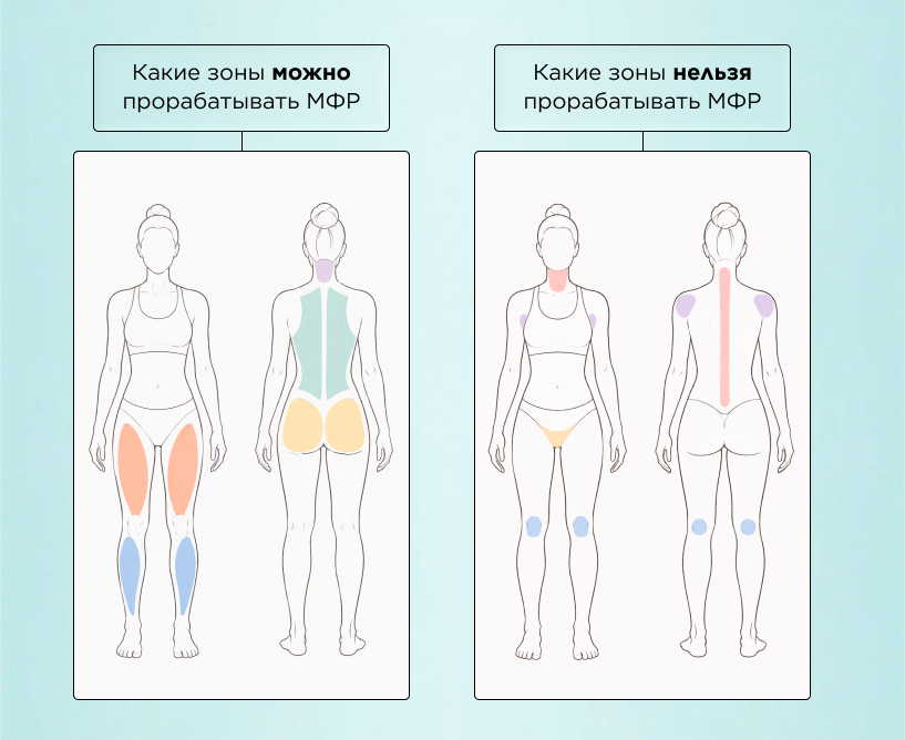 Какие зоны можно прорабатывать МФР