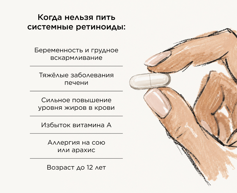 Когда нельзя пить системные ретиноиды