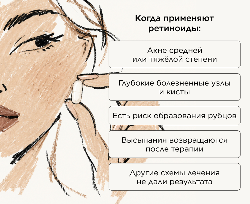 Когда применяют ретиноиды