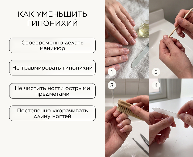 Что делать, если гипонихий разросся
