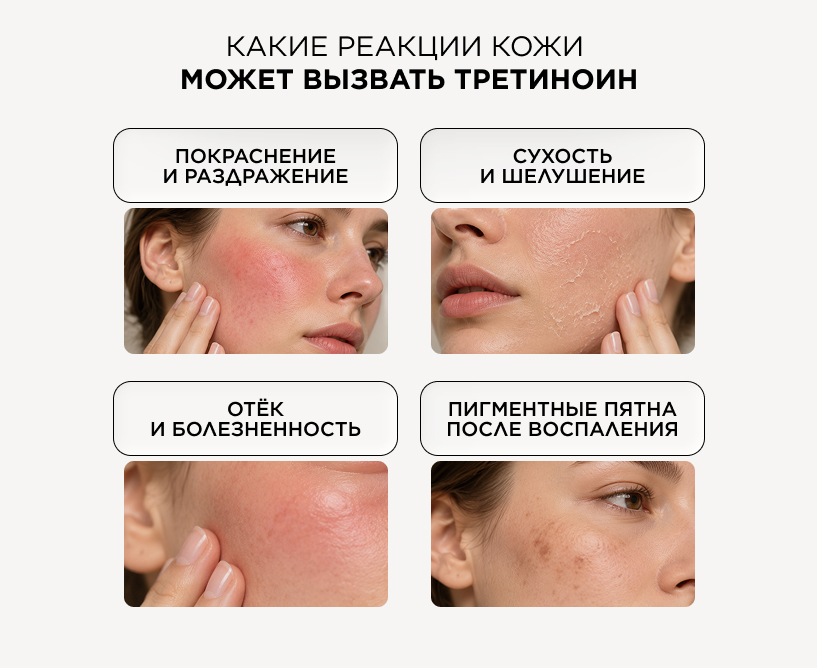 Чем опасен третиноин для кожи